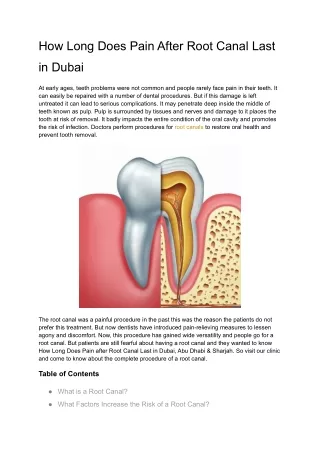 How Long Does Pain After Root Canal Last in Dubai