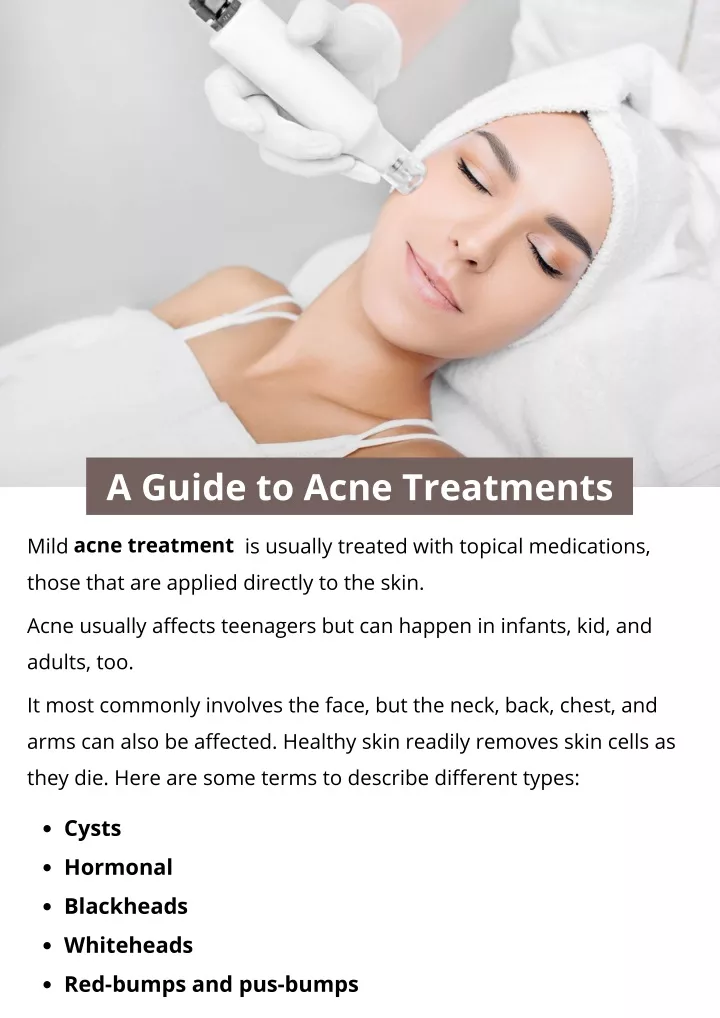 a guide to acne treatments