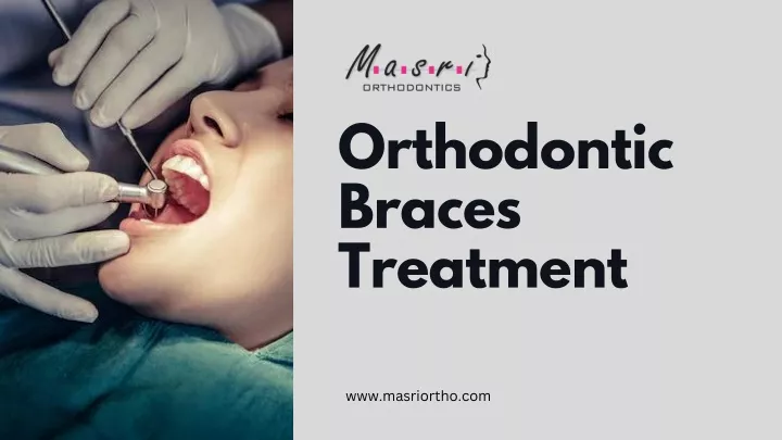 orthodontic braces treatment