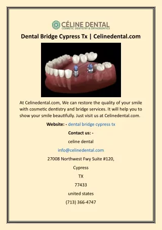 Dental Bridge Cypress Tx  Celinedental