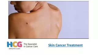 Treatment Options for Skin Cancer
