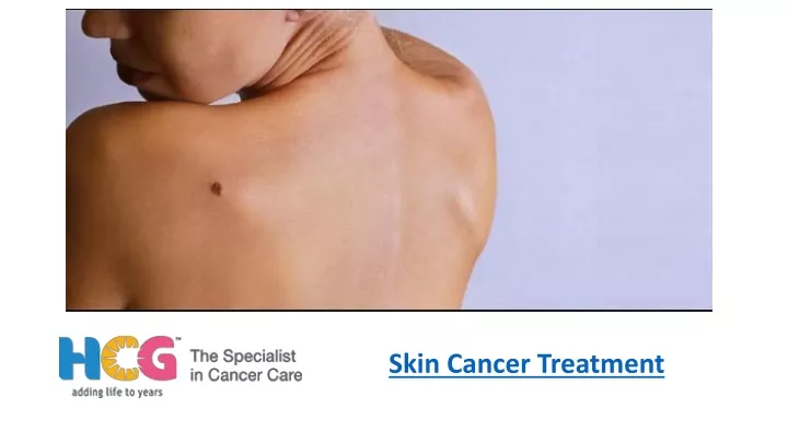 skin cancer treatment