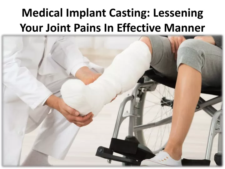 medical implant casting lessening your joint pains in effective manner