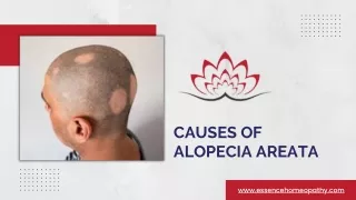Exploring the Root Causes of Alopecia Areata: A Comprehensive Guide