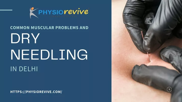 common muscular problems and dry needling in delhi