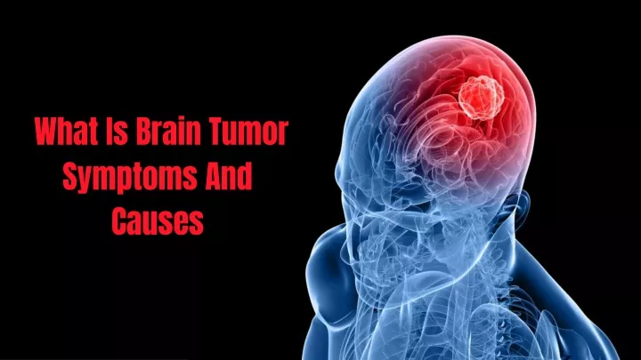 what is brain tumor symptoms and causes