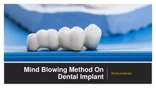Mind Blowing Method On Dental Implant