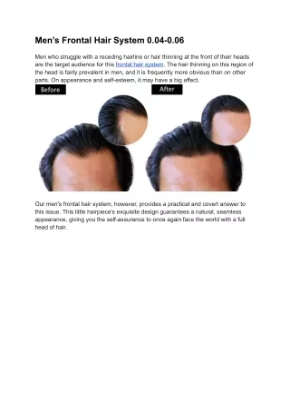Men’s Frontal Hair System 0.04-0.06