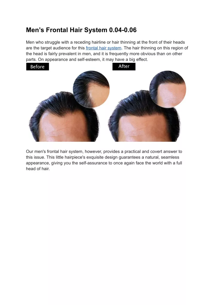 men s frontal hair system 0 04 0 06