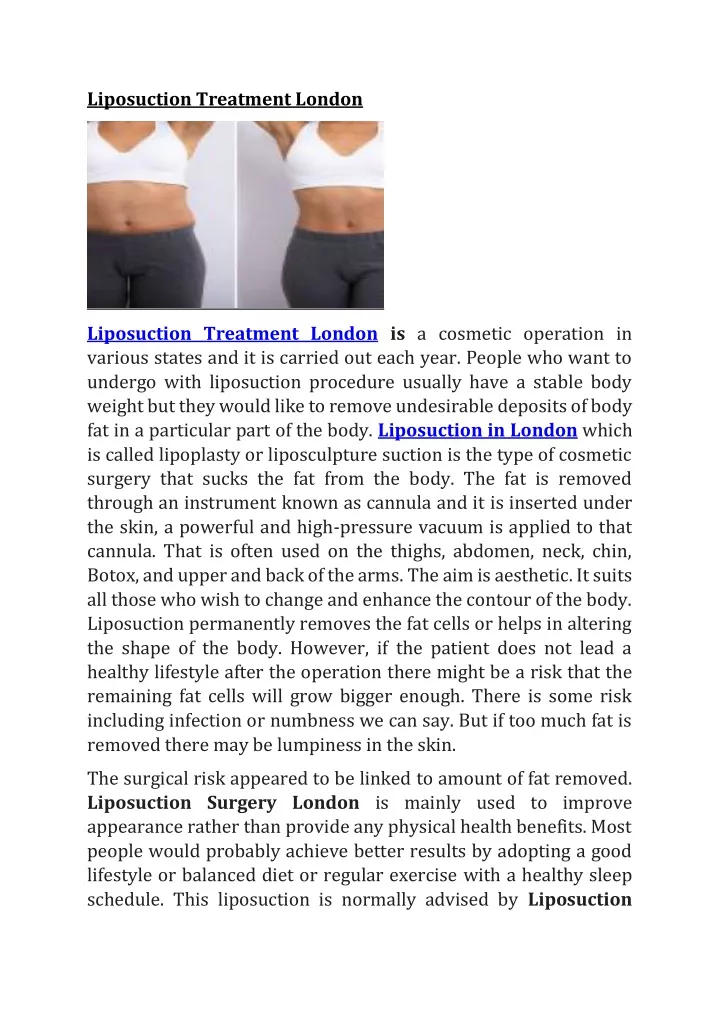 liposuction treatment london