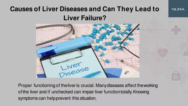 causes of liver diseases and c an t hey l ead to liver failure