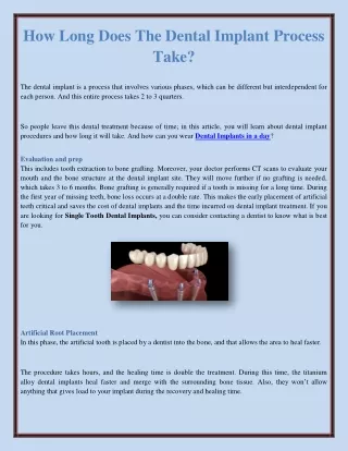 How Long Does The Dental Implant Process Take?