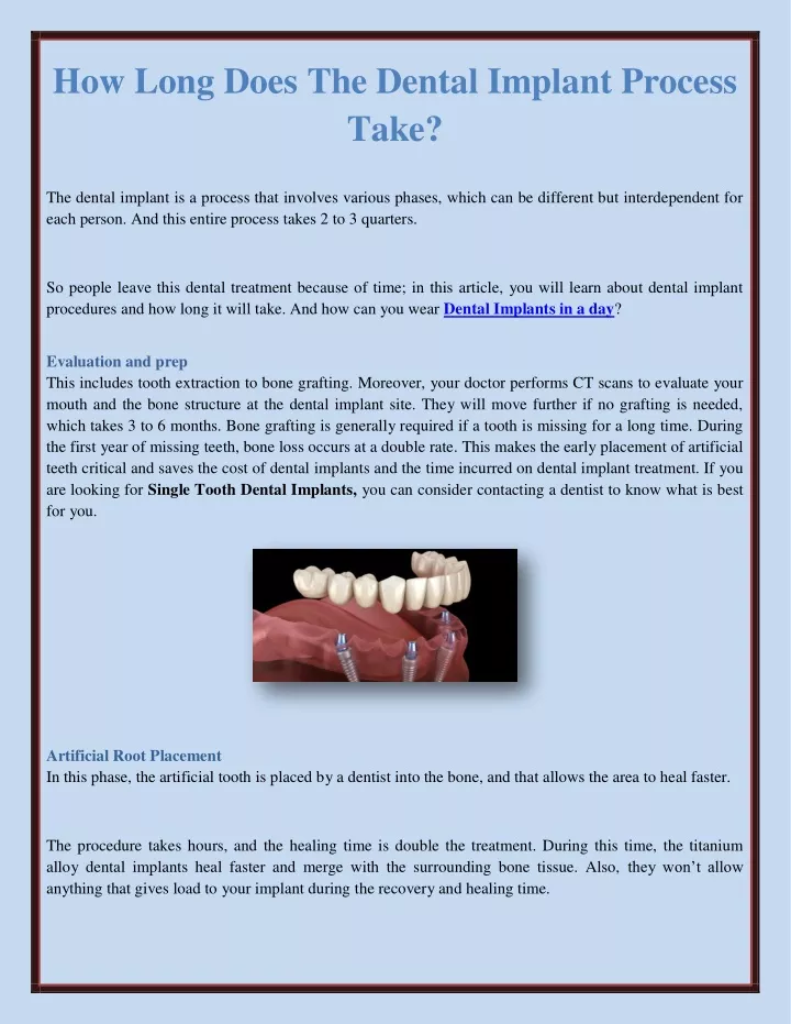 how long does the dental implant process take