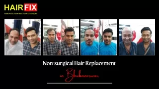 Non-surgical Hair Replacement in Bhubaneswar