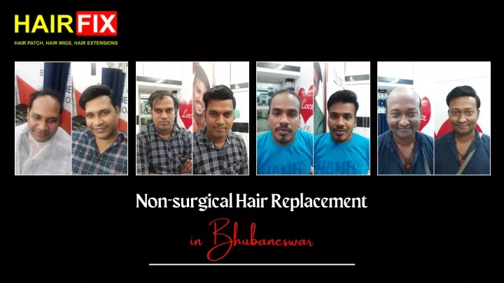 non surgical hair replacement in bhubaneswar