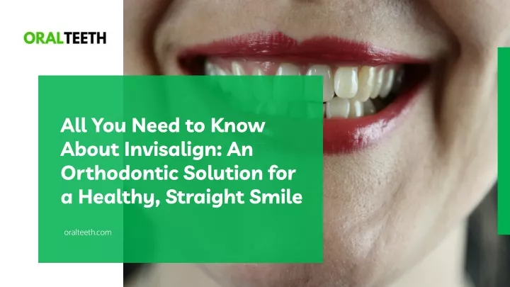 all you need to know about invisalign