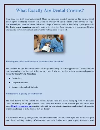What Exactly Are Dental Crowns?