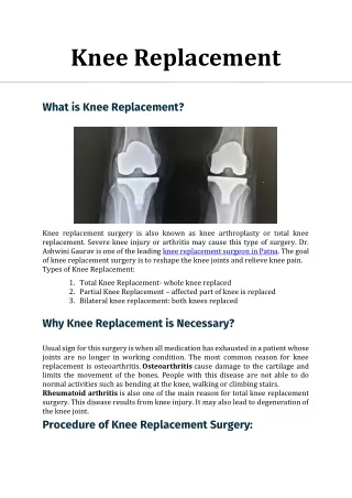 Knee Replacement