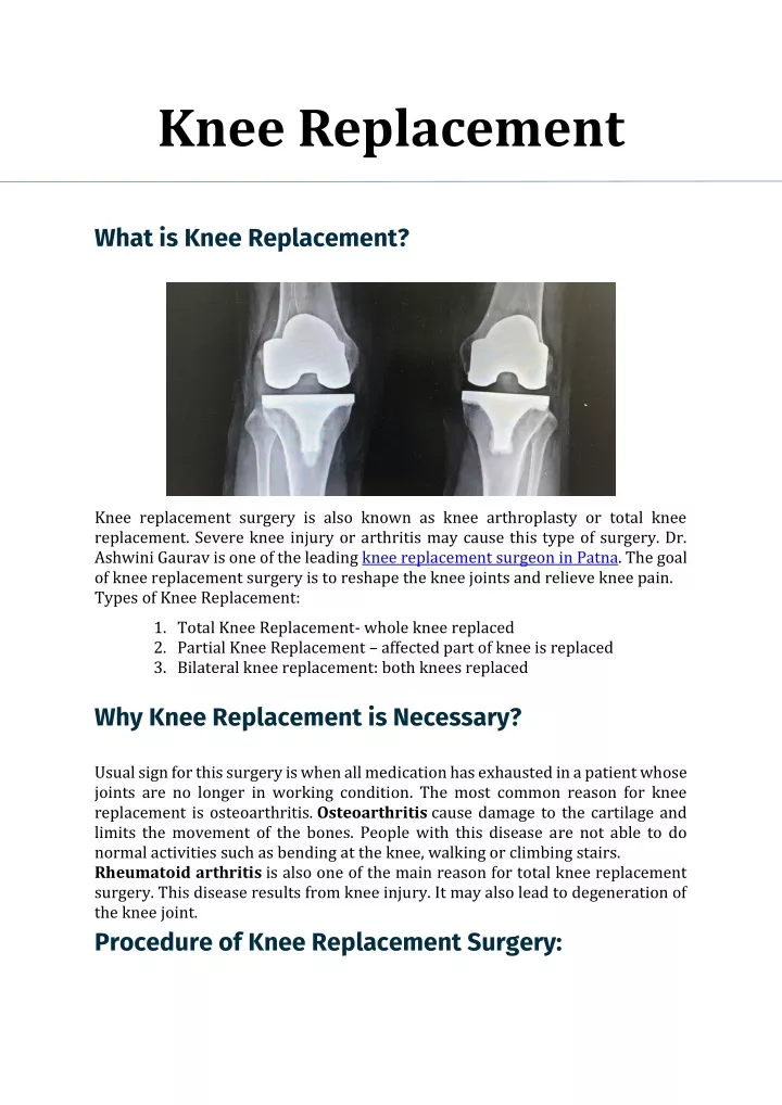 knee replacement