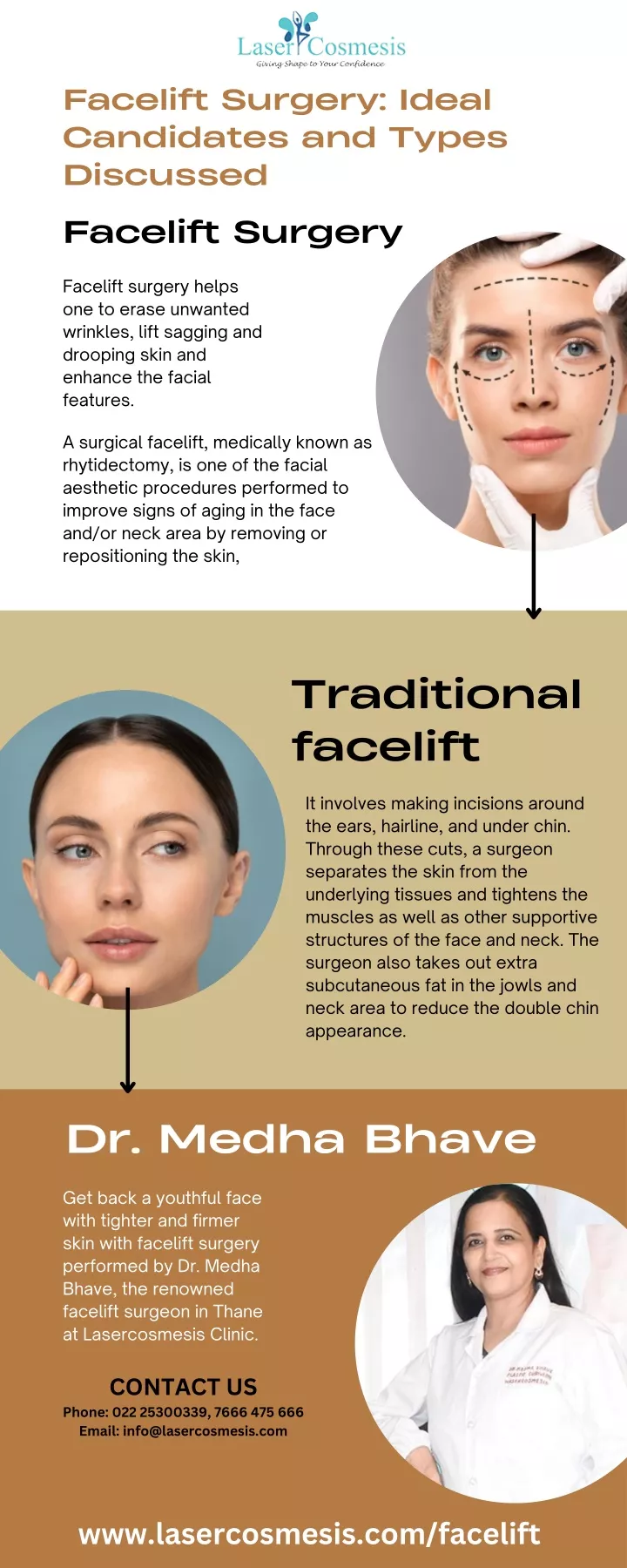 facelift surgery ideal candidates and types