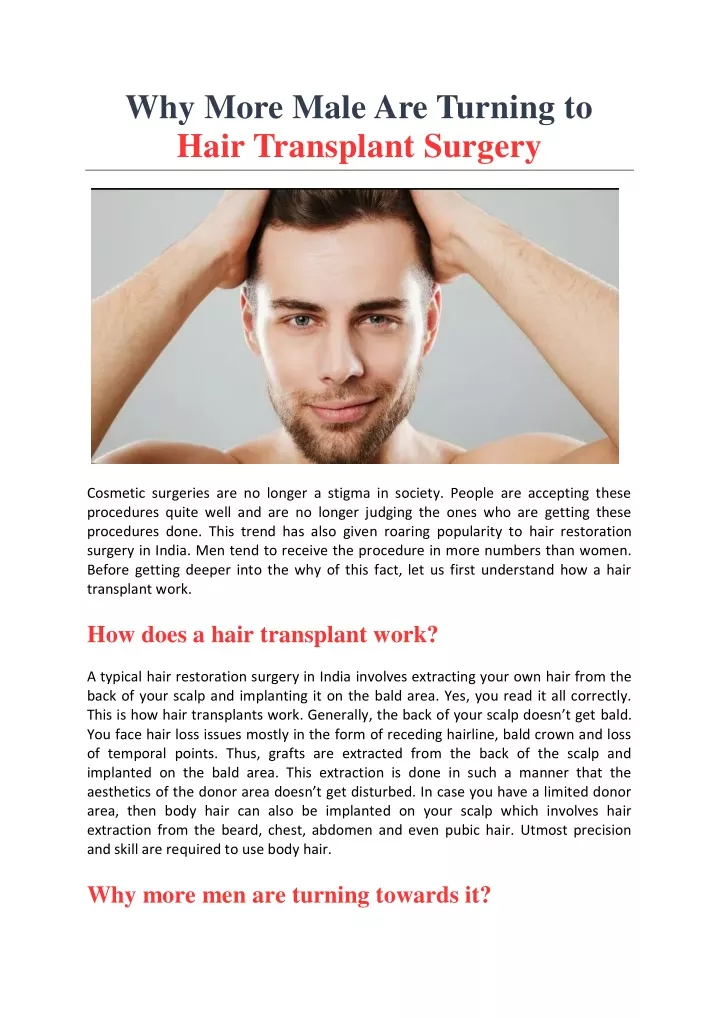why more male are turning to hair transplant