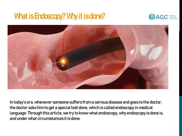 what is endoscopy why it is done