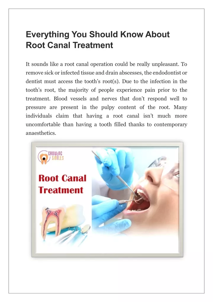 everything you should know about root canal