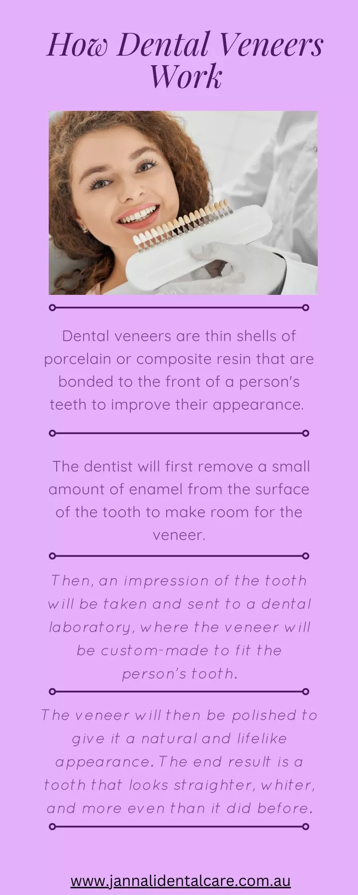 how dental veneers work