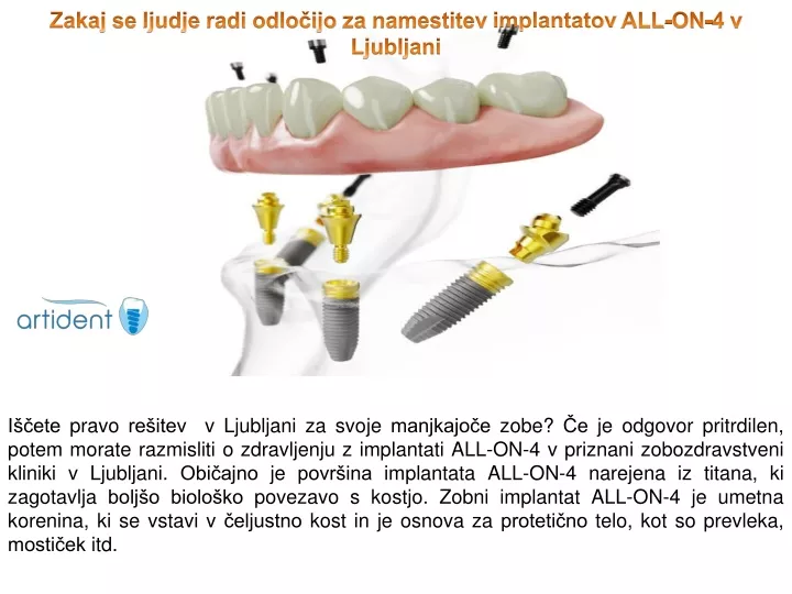 zakaj se ljudje radi odlo ijo za namestitev