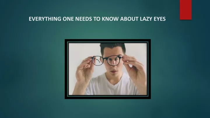 everything one needs to know about lazy eyes