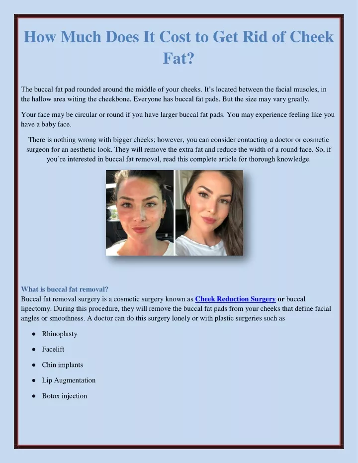 how much does it cost to get rid of cheek fat