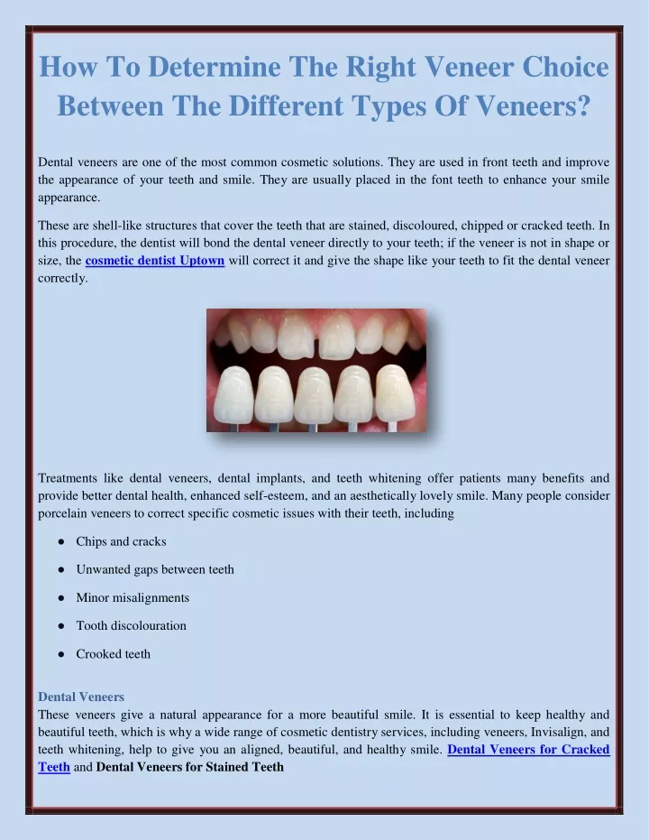 how to determine the right veneer choice between
