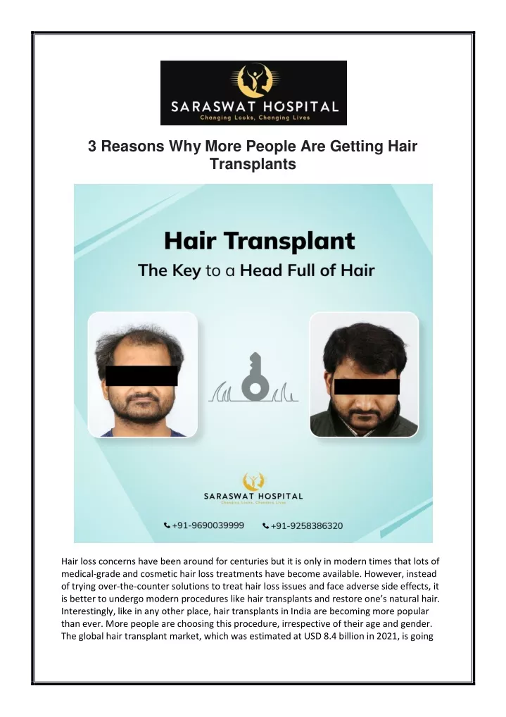 3 reasons why more people are getting hair