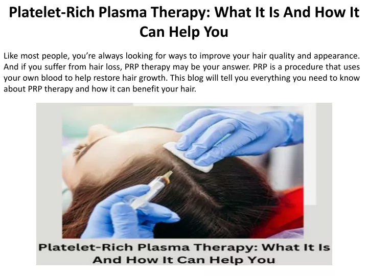 platelet rich plasma therapy what