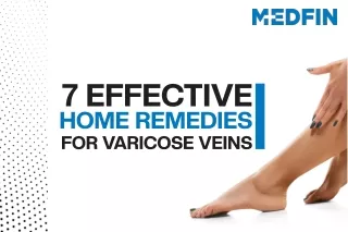 7 Effective Home Remedies for Varicose Veins | Varicose Veins Home Treatment