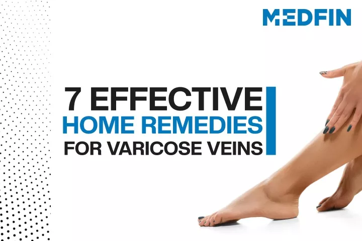 PPT - 7 Effective Home Remedies For Varicose Veins | Varicose Veins ...