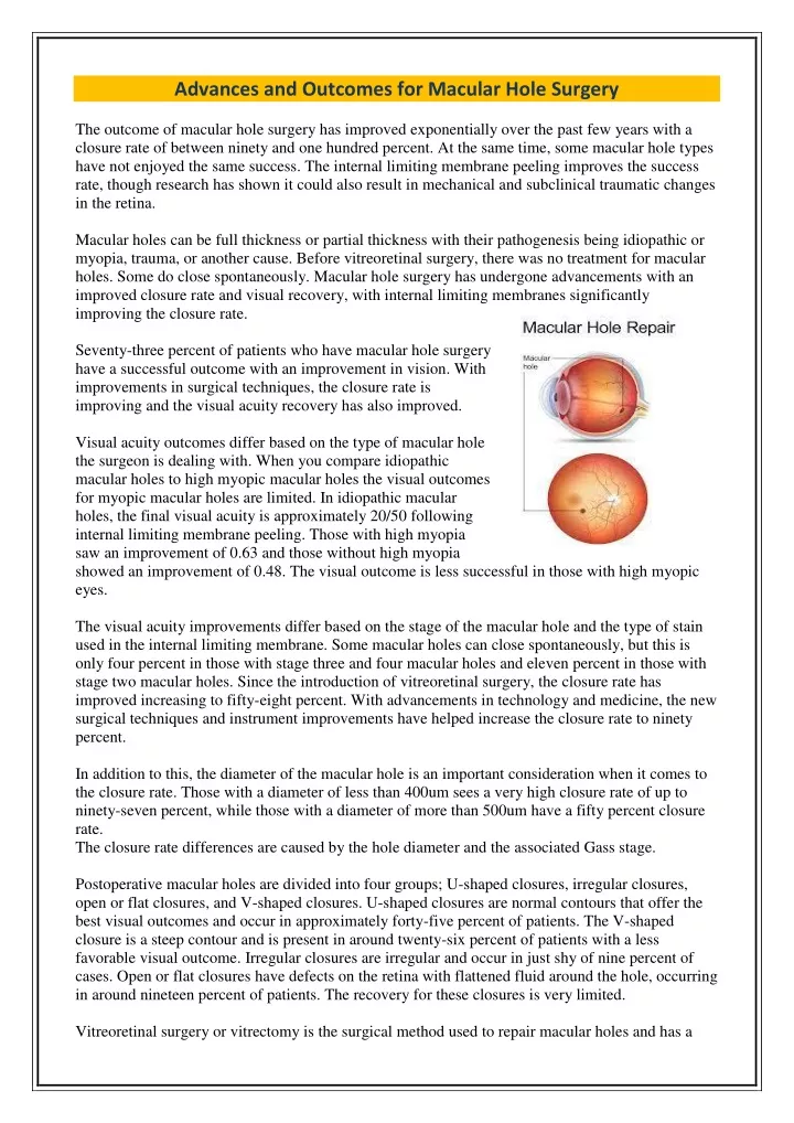 advances and outcomes for macular hole surgery