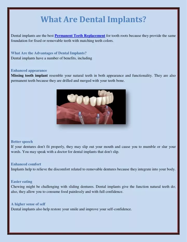 what are dental implants