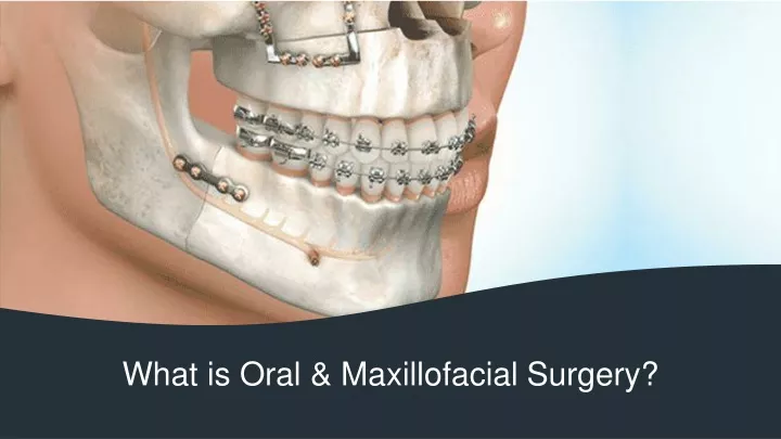 what is oral maxillofacial surgery