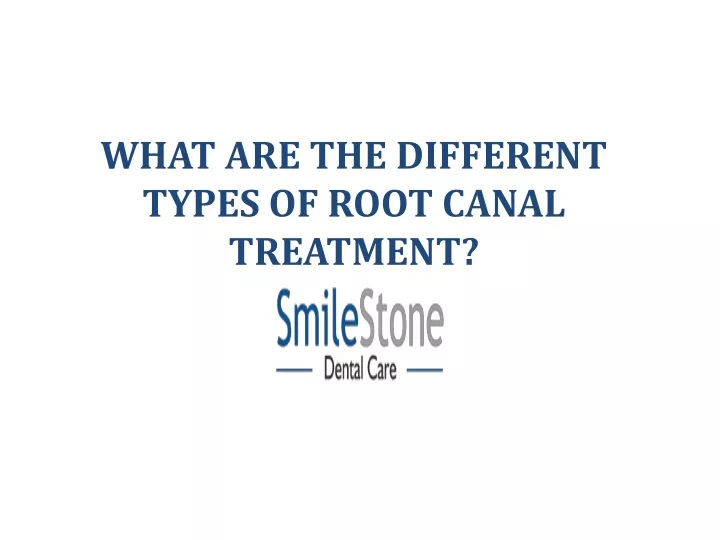 what are the different types of root canal treatment