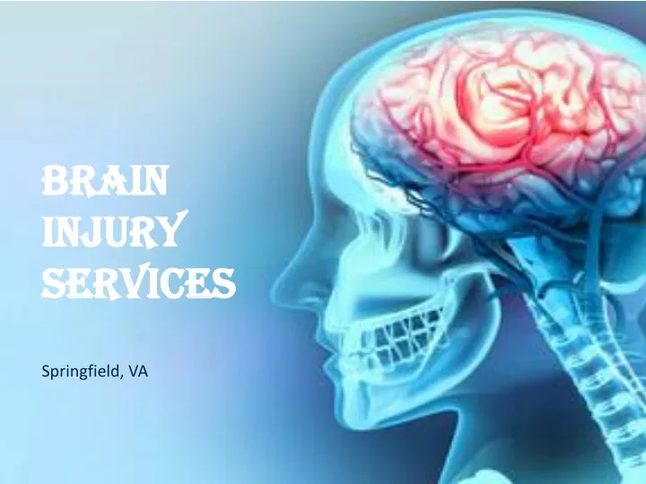 brain injury services springfield va