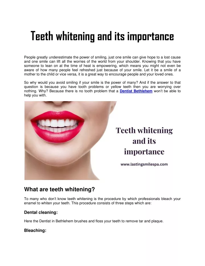 teeth whitening and its importance