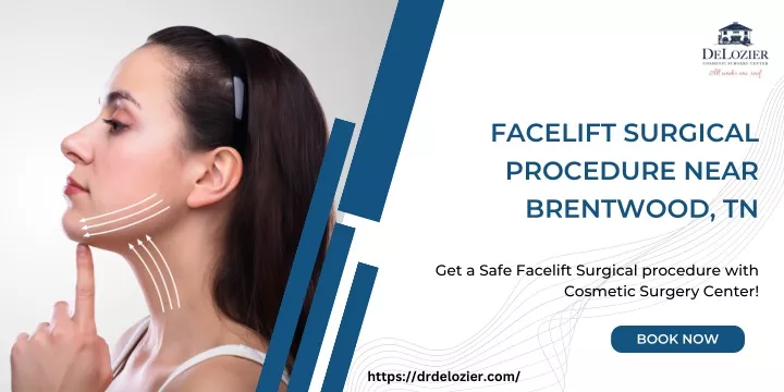facelift surgical procedure near brentwood tn