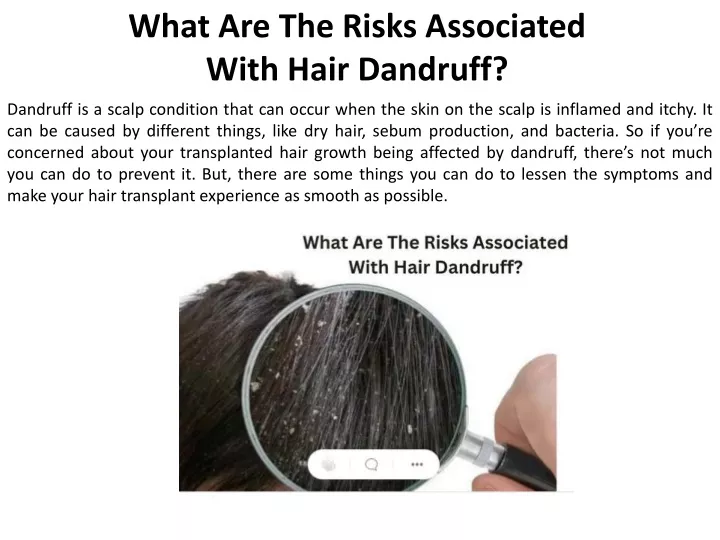 what are the risks associated with hair dandruff