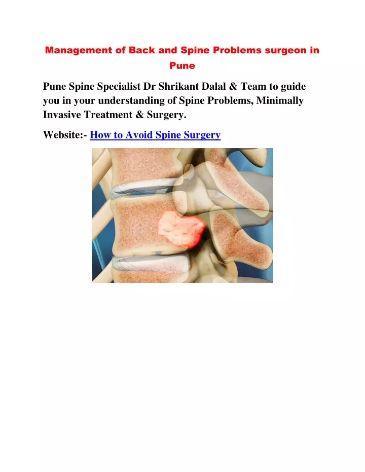 management of back and spine problems surgeon