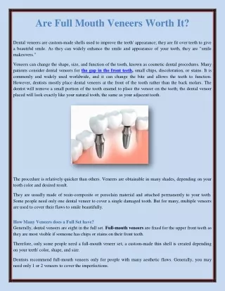 Are Full Mouth Veneers Worth It?