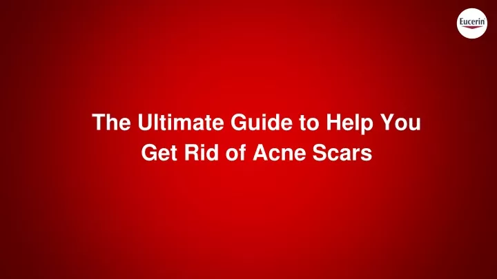 the ultimate guide to help you get rid of acne