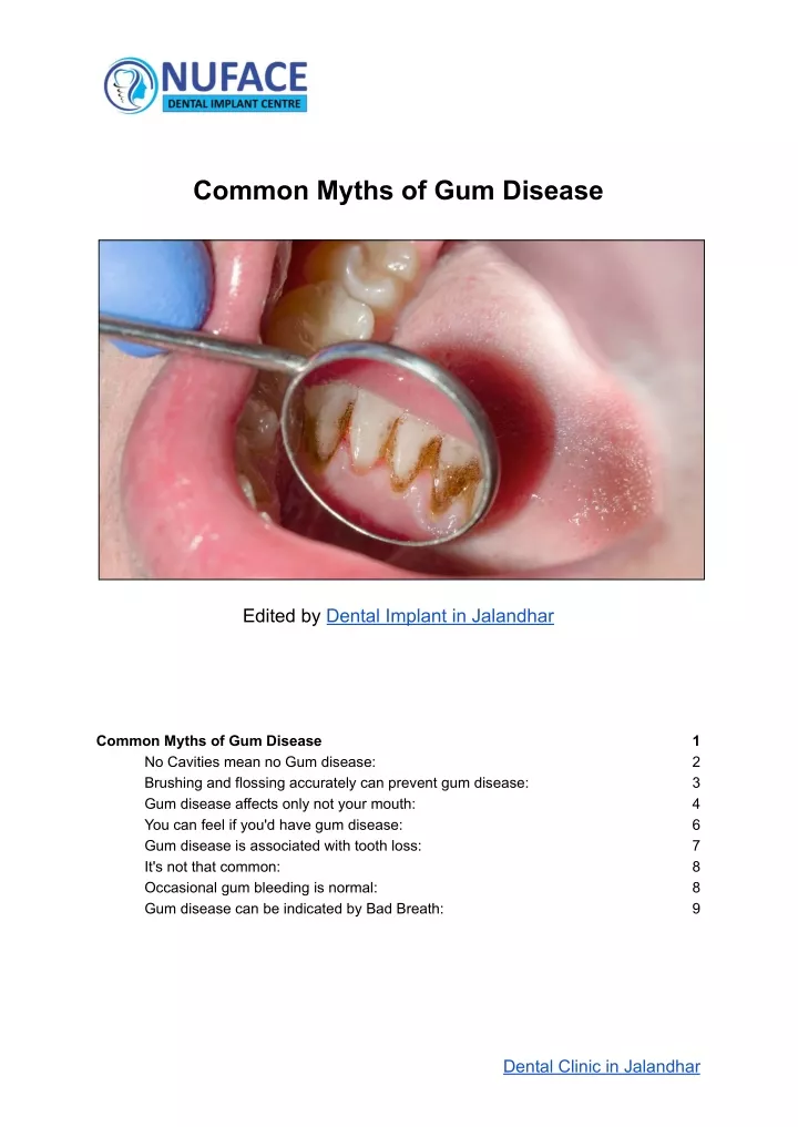 common myths of gum disease