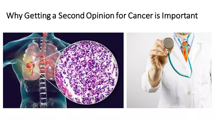 why getting a second opinion for cancer