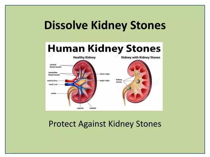 dissolve kidney stones